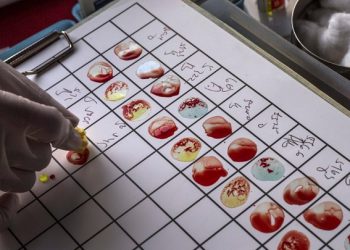 Υπό ανάπτυξη το πρώτο τεστ αίματος για τη διάγνωση της έλλειψης ύπνου