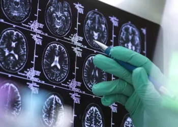 Πρωτοπόρα εφαρμογή πρόβλεψης του αλτσχάιμερ από Έλληνες